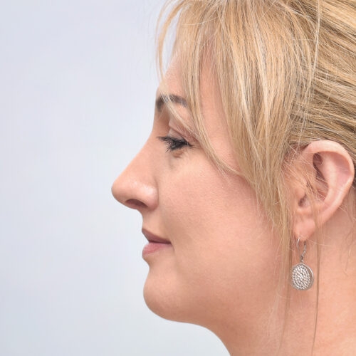 michal20b-mamy-zgode-aspect-ratio-500-500