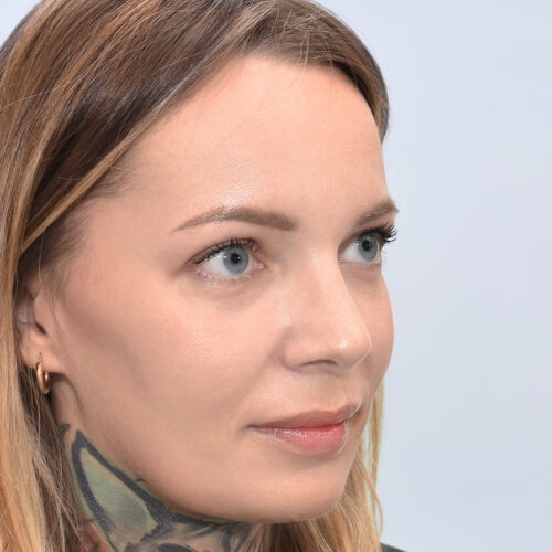 michal24b-aspect-ratio-500-500