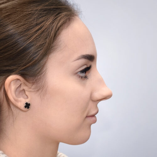 michal25a-mamy-zgode-aspect-ratio-500-500