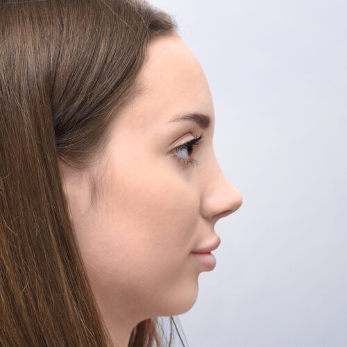 michal25b-aspect-ratio-500-500