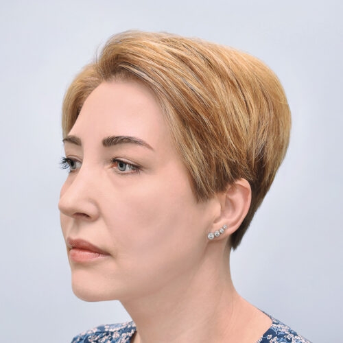 michal29b-aspect-ratio-500-500