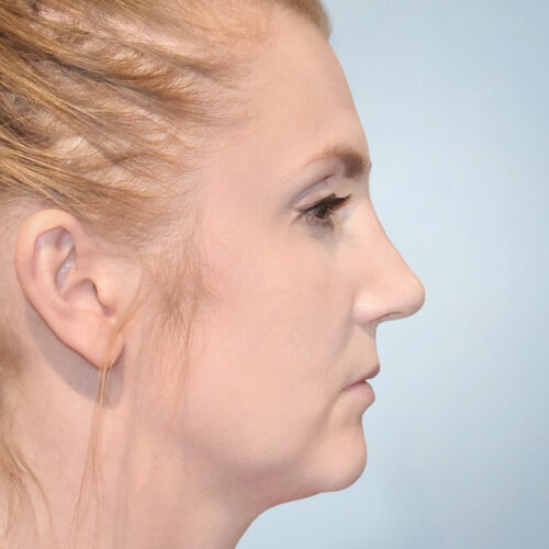 michal2b-aspect-ratio-500-500