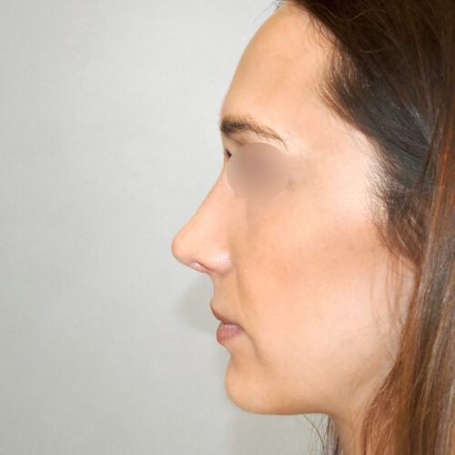 michal3b-aspect-ratio-500-500