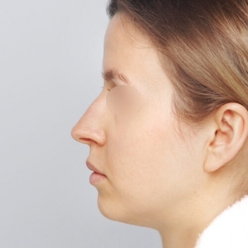 michal4a-aspect-ratio-500-500