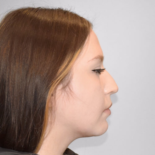 michal7a-aspect-ratio-500-500