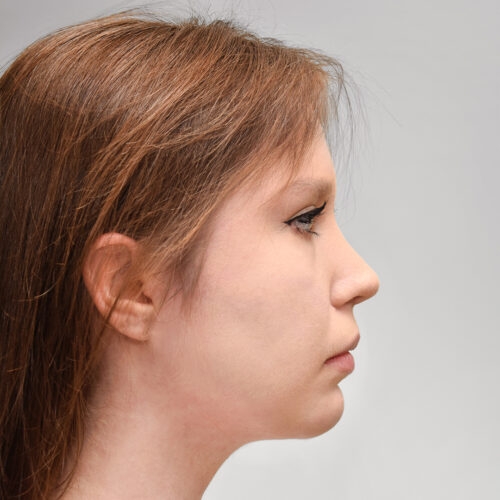 michal7b-aspect-ratio-500-500