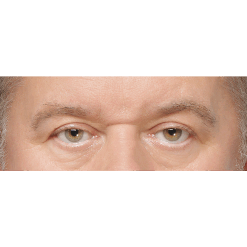 miszczyk-brwi-id67158-16a-aspect-ratio-500-500