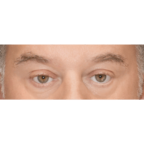 miszczyk-brwi-id67158-16b-aspect-ratio-500-500