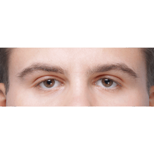 miszczyk-endo-brwi-id70931-przyciete-13a-aspect-ratio-500-500