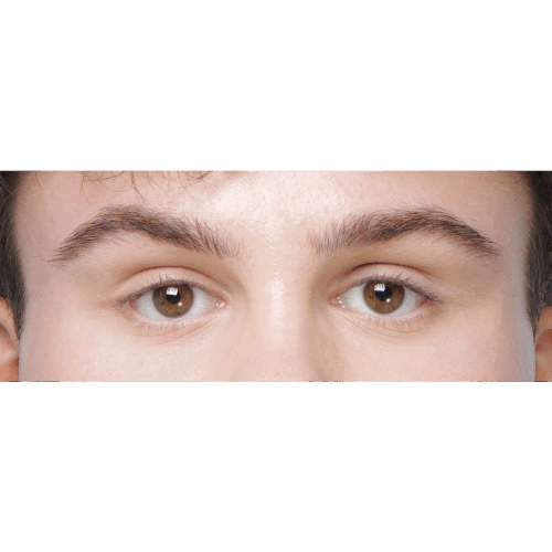 miszczyk-endo-brwi-id70931-przyciete-13b-aspect-ratio-500-500