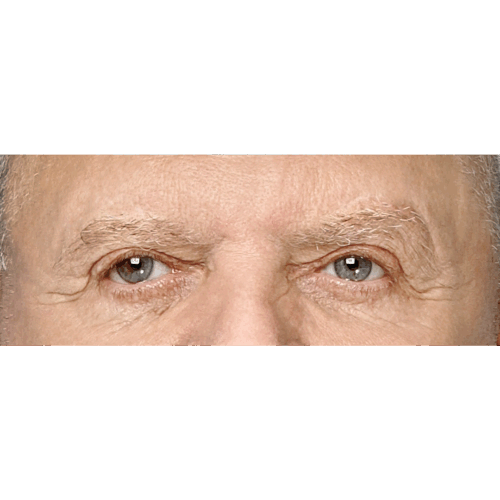 miszczyk-lift-brwi-10a-aspect-ratio-500-500