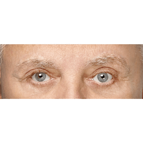 miszczyk-lift-brwi-10b-aspect-ratio-500-500