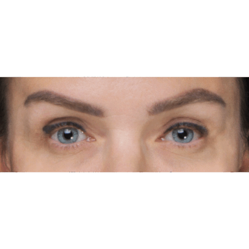 miszczyk-lift-brwi-11a-aspect-ratio-500-500