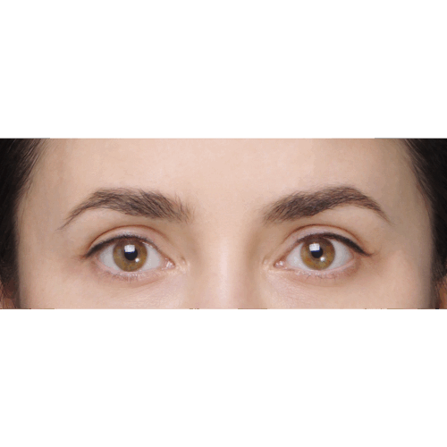 miszczyk-lift-brwi-14a-aspect-ratio-500-500