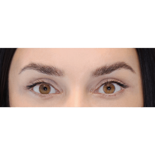 miszczyk-lift-brwi-14b-aspect-ratio-500-500