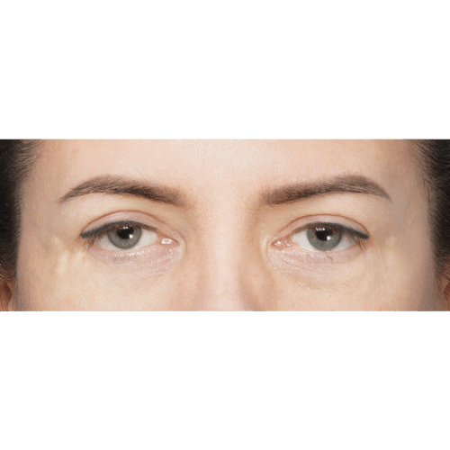 miszczyk-lift-brwi-7a-090524-aspect-ratio-500-500