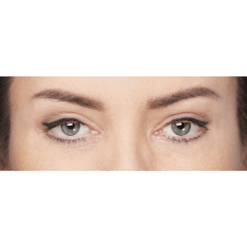 miszczyk-lift-brwi-7b-090524-aspect-ratio-500-500