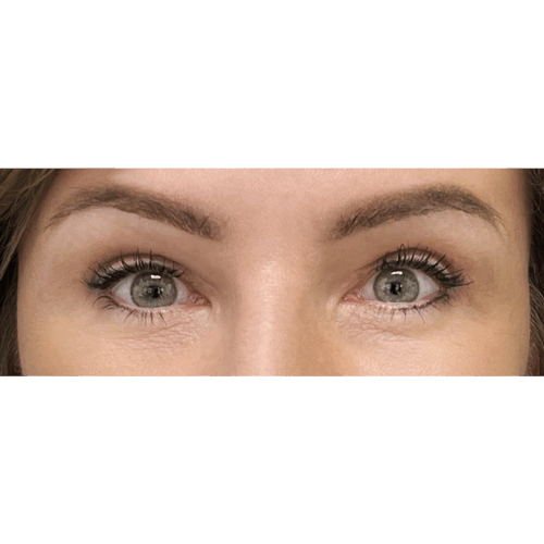 miszczyk-powieki-7b-090524-aspect-ratio-500-500