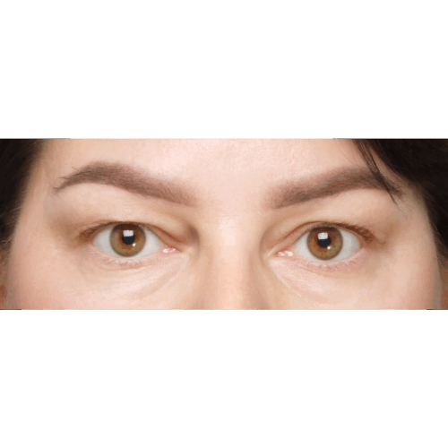 miszczyk-powieki-8a-090524-aspect-ratio-500-500