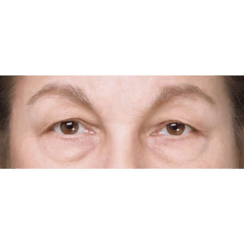 miszczyk-powieki-g-d-1a-aspect-ratio-500-500