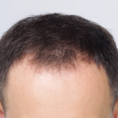 miszczyk-wlosy-27c-aspect-ratio-500-500