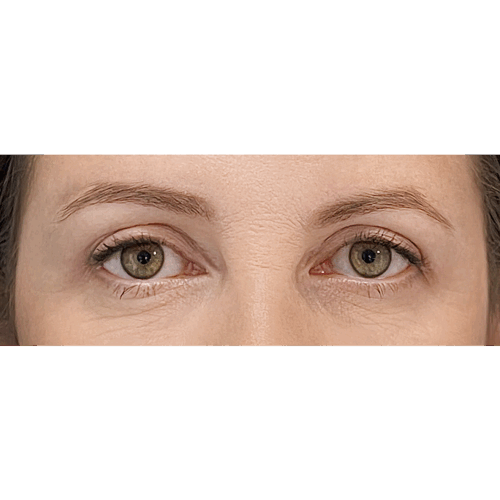 miszczyki-powieki-6b-img-4695-aspect-ratio-500-500