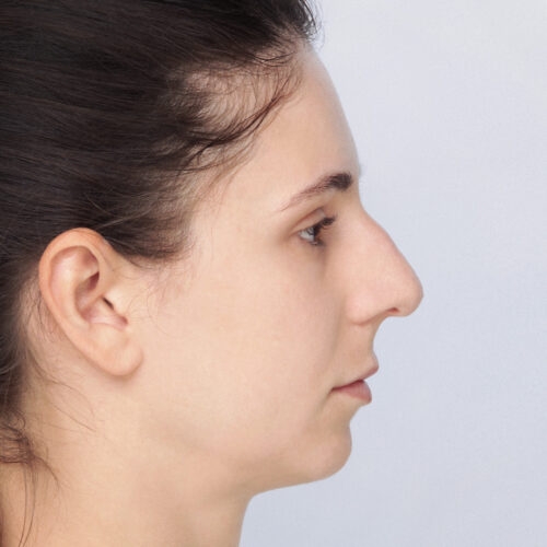 stabryla-nos-id61346-16a-aspect-ratio-500-500