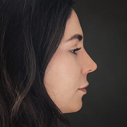 stabryla-nos-id61346-16b-aspect-ratio-500-500