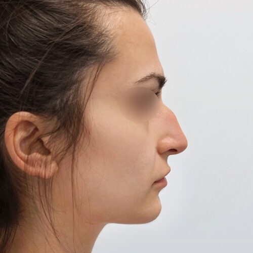 stabryla2a-aspect-ratio-500-500