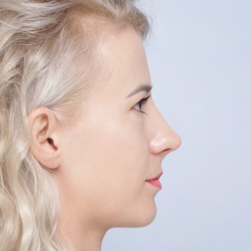 stabryla7b-aspect-ratio-500-500