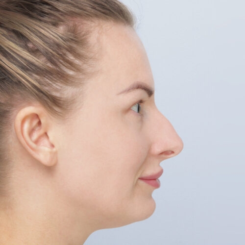 stabryla8a-zgoda-aspect-ratio-500-500