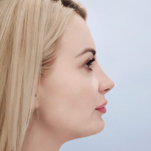 stabryla8b-zgoda-aspect-ratio-500-500