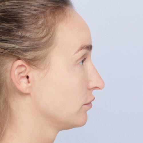 stabryla9a-60999-mamy-zgode-aspect-ratio-500-500