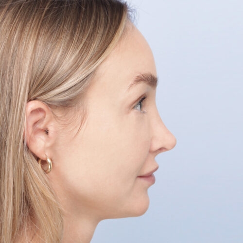 stabryla9b-60999-aspect-ratio-500-500