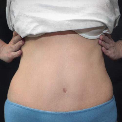 daria-id64500-brzuch-23b-aspect-ratio-500-500