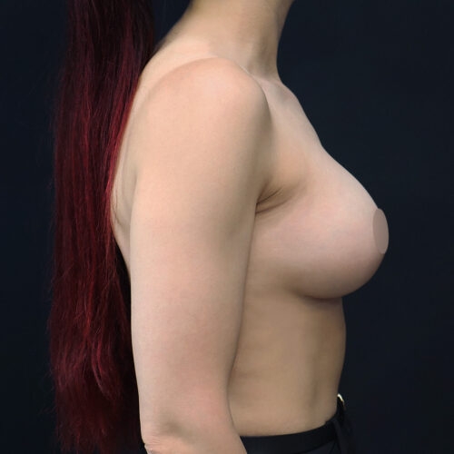 daria-id70362-implanty-31d-aspect-ratio-500-500