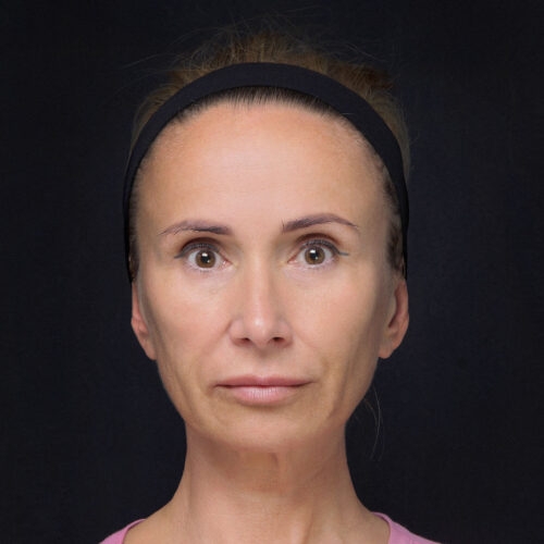 michal-dpfll–id72069-21a-aspect-ratio-500-500