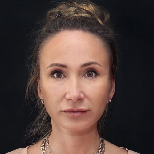 michal-dpfll–id72069-21b-aspect-ratio-500-500