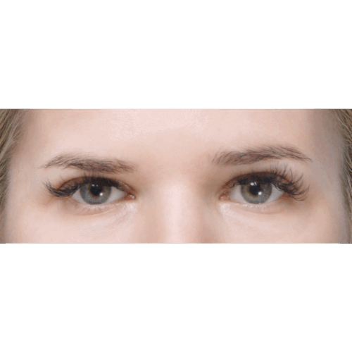 miszczyk-endo-brwi-id70212-19a-aspect-ratio-500-500