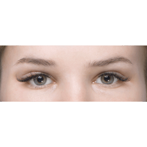 miszczyk-endo-brwi-id70212-19b-aspect-ratio-500-500