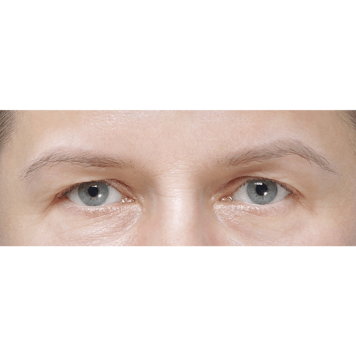 miszczyk-endo-brwi-id71526-20a-aspect-ratio-500-500