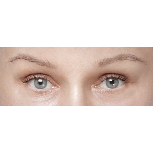 miszczyk-endo-brwi-id71526-20b-aspect-ratio-500-500